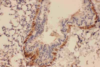 2 - Anti-Collagen IV Antibody ABO10840