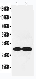 1 - Anti-Collagen IV Antibody ABO10840