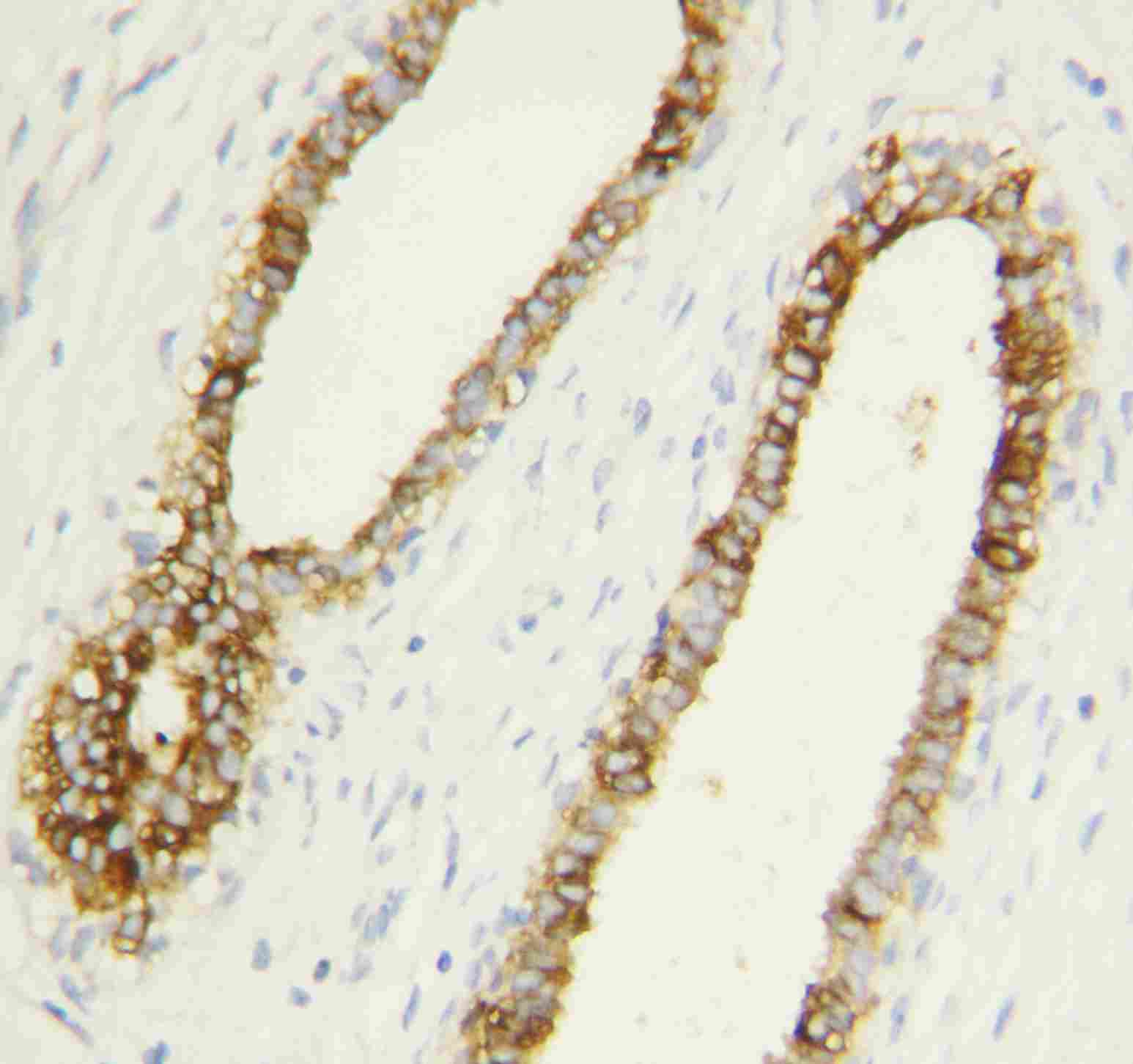 2 - Anti-Caspase-1(P10) Antibody ABO10841
