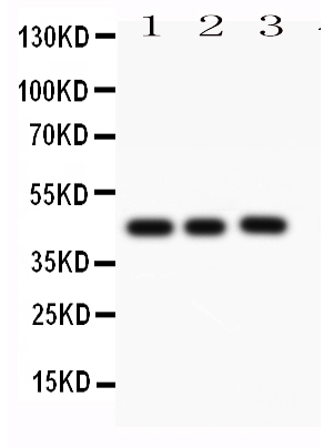 1 - Anti-Caspase-1(P10) Antibody ABO10841