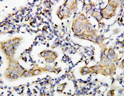 2 - Anti-Caspase-8(P10) Antibody ABO10842