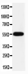 1 - Anti-Caspase-8(P10) Antibody ABO10842