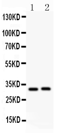 1 - Anti-IL-1 beta Antibody ABO10850