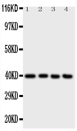 1 - Anti-ATF4 Antibody ABO10855