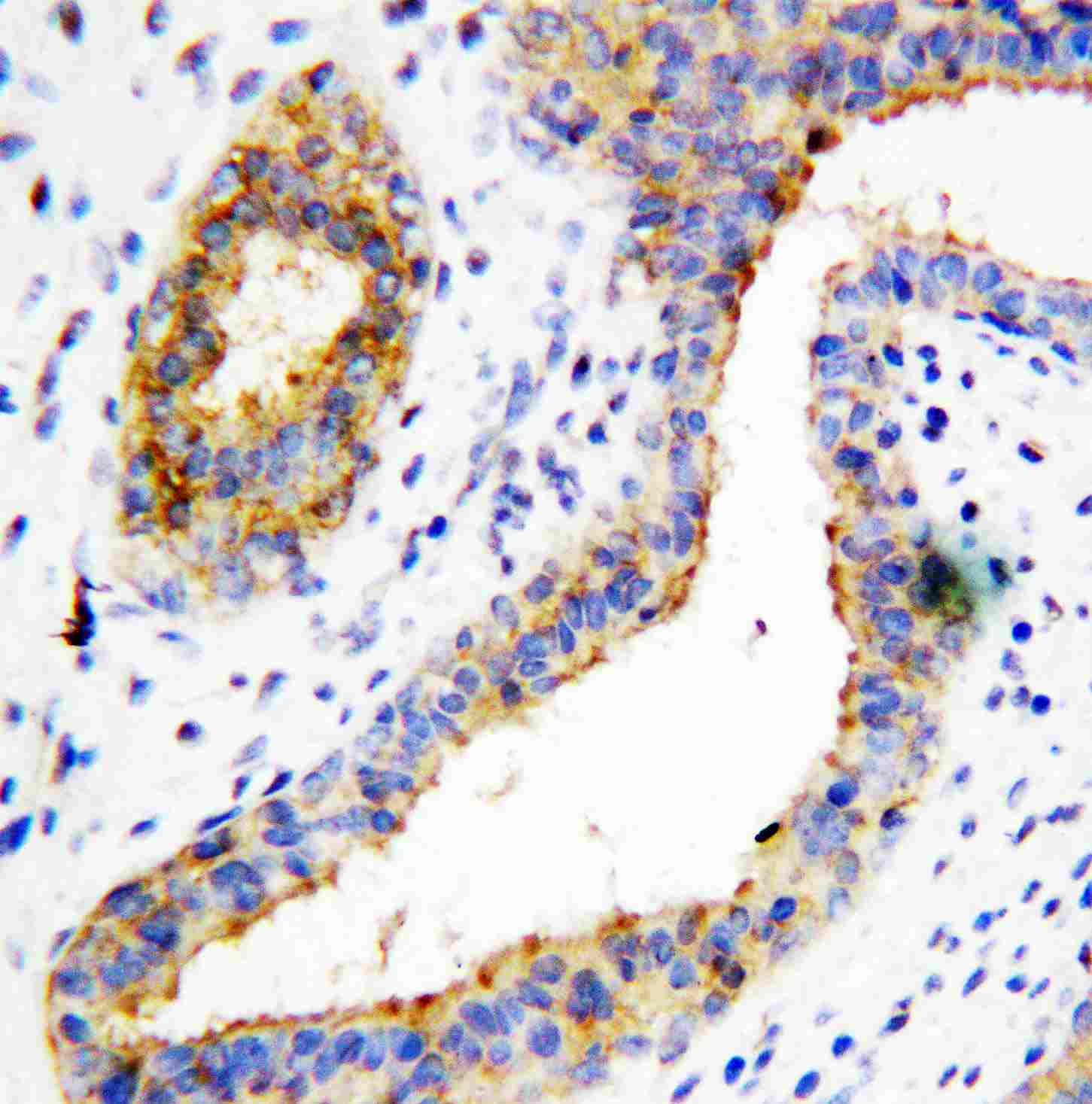 2 - Anti-BCAT1 Antibody ABO10856