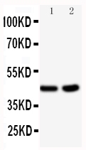 1 - Anti-BCAT1 Antibody ABO10856