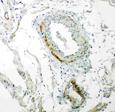 2 - Anti-Caveolin-2 Antibody ABO10858