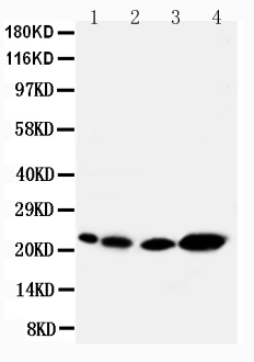 1 - Anti-Caveolin-2 Antibody ABO10858