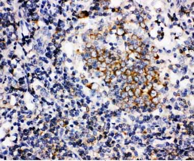 2 - Anti-BAFF Antibody ABO10859