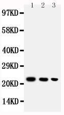 1 - Anti-BAFF Antibody ABO10859