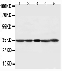 1 - Anti-CDK1 Antibody ABO10861