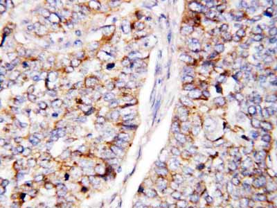 2 - Anti-Cdc25B Antibody ABO10863
