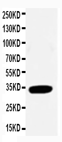 1 - Anti-Cdk2 Antibody ABO10864