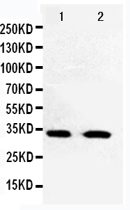 1 - Anti-Cdk5 Antibody ABO10865