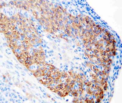 2 - Anti-hCG Receptor Antibody ABO10870