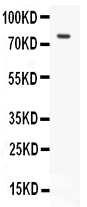 1 - Anti-hCG Receptor Antibody ABO10870