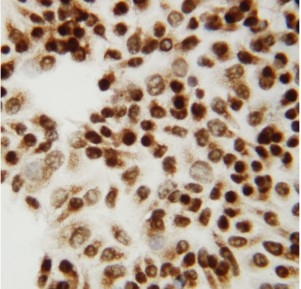 8 - Anti-CTBP2 Antibody ABO10872