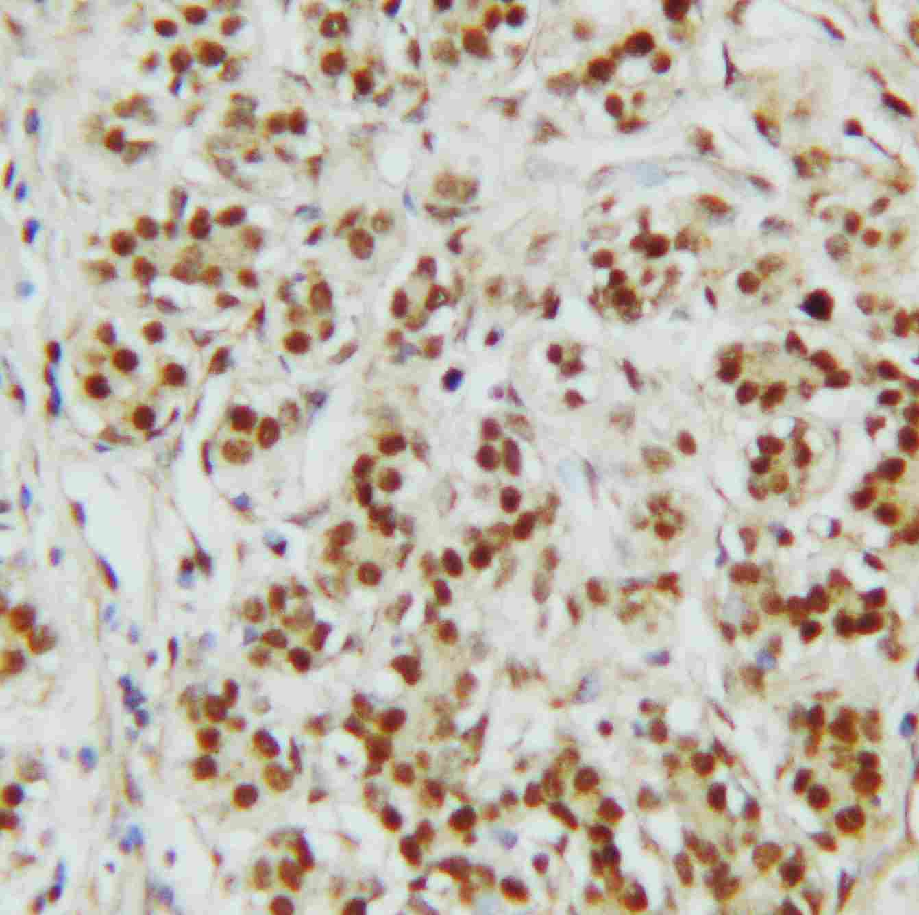 2 - Anti-CTBP2 Antibody ABO10872