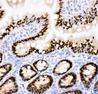 2 - Anti-CTBP2 Antibody ABO10872