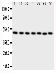 1 - Anti-CTBP2 Antibody ABO10872