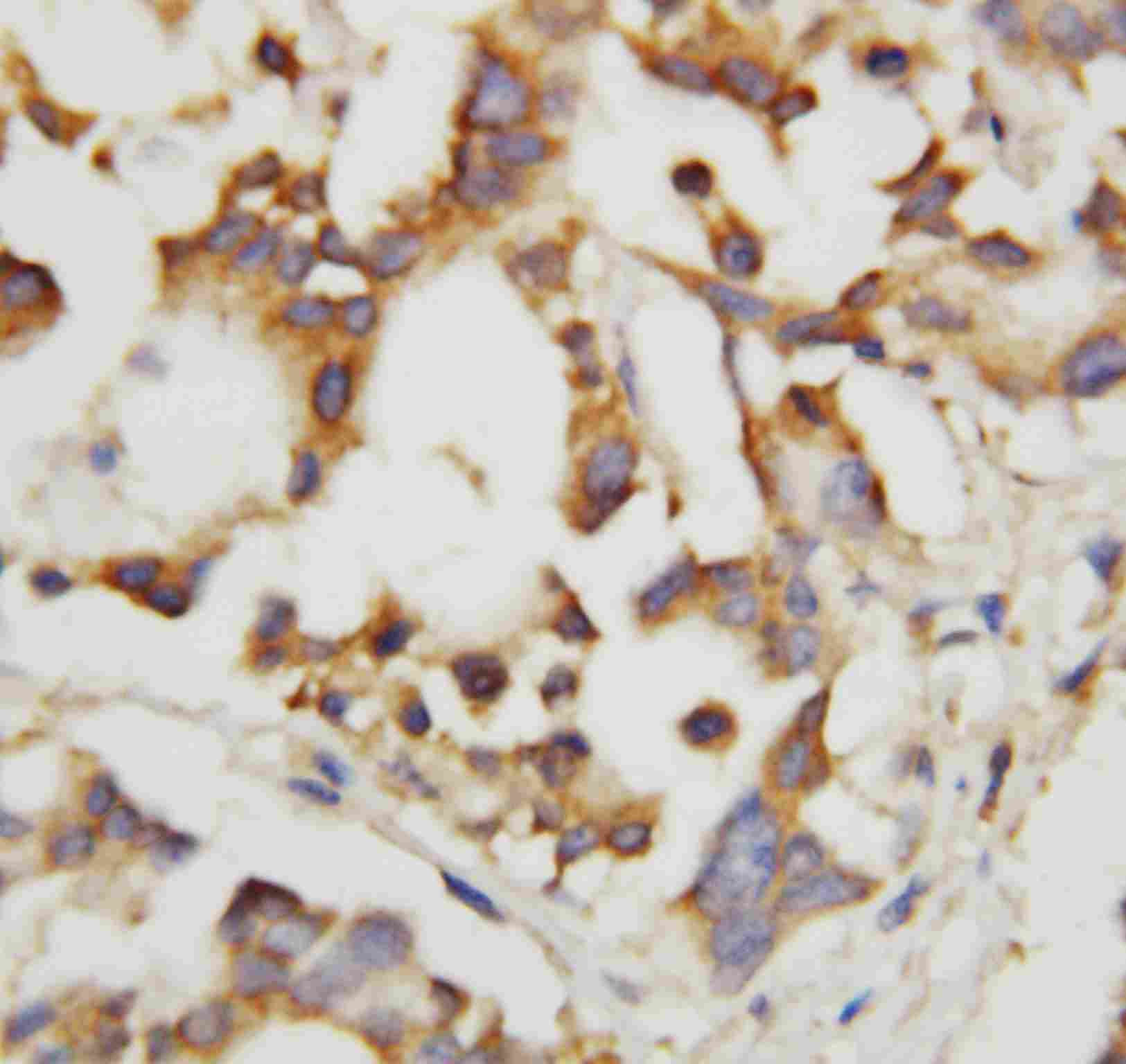 2 - Anti-Cystathionase Antibody ABO10874