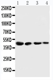 1 - Anti-Cystathionase Antibody ABO10874