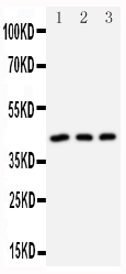 1 - Anti-DAP Kinase 2 Antibody ABO10876