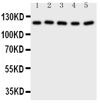 1 - Anti-Desmoglein 2 Antibody ABO10877