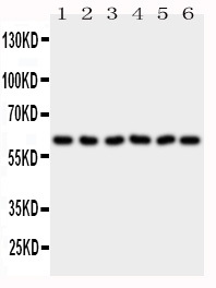 1 - Anti-PAK1 Antibody ABO10881
