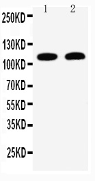 1 - Anti-Desmoglein 3 Antibody ABO10883
