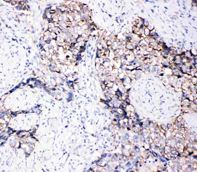 2 - Anti-Eph Receptor B3 Antibody ABO10884