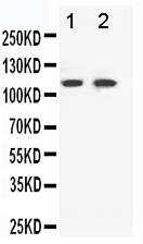 1 - Anti-Eph Receptor B3 Antibody ABO10884