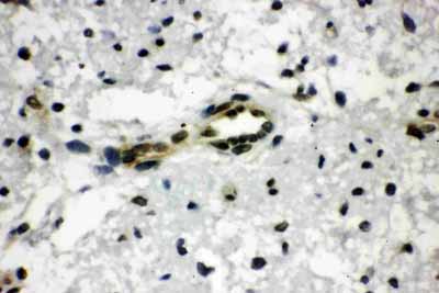 2 - Anti-CtBP1 Antibody ABO10885