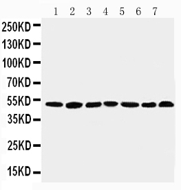 1 - Anti-CtBP1 Antibody ABO10885