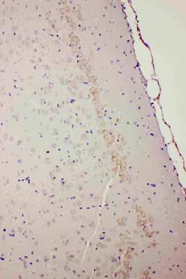 2 - Anti-DRD1 Antibody ABO10886