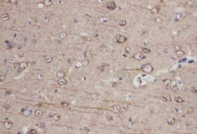 2 - Anti-Eph Receptor A1 Antibody ABO10887