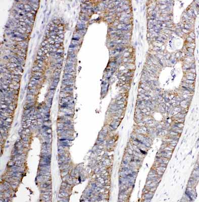 2 - Anti-Eph Receptor A1 Antibody ABO10887