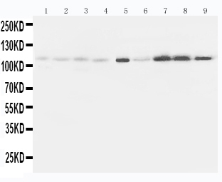 1 - Anti-Eph Receptor A1 Antibody ABO10887