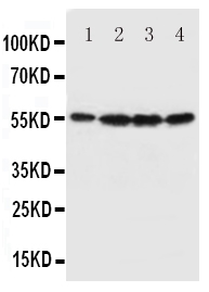 1 - Anti-Fascin Antibody ABO10889