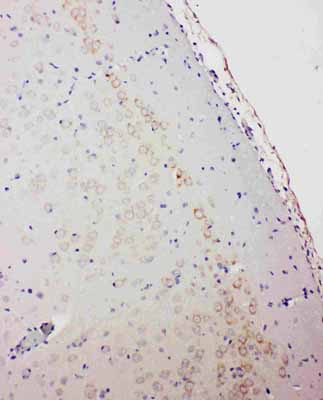 2 - Anti-GABA A Receptor Alpha 1 Antibody ABO10892