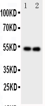 1 - Anti-GABA A Receptor Alpha 1 Antibody ABO10892