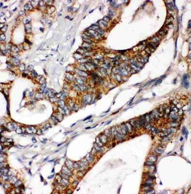 2 - Anti-Laminin Gamma 1 Antibody ABO10895