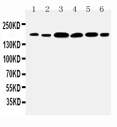 1 - Anti-Laminin Gamma 1 Antibody ABO10895