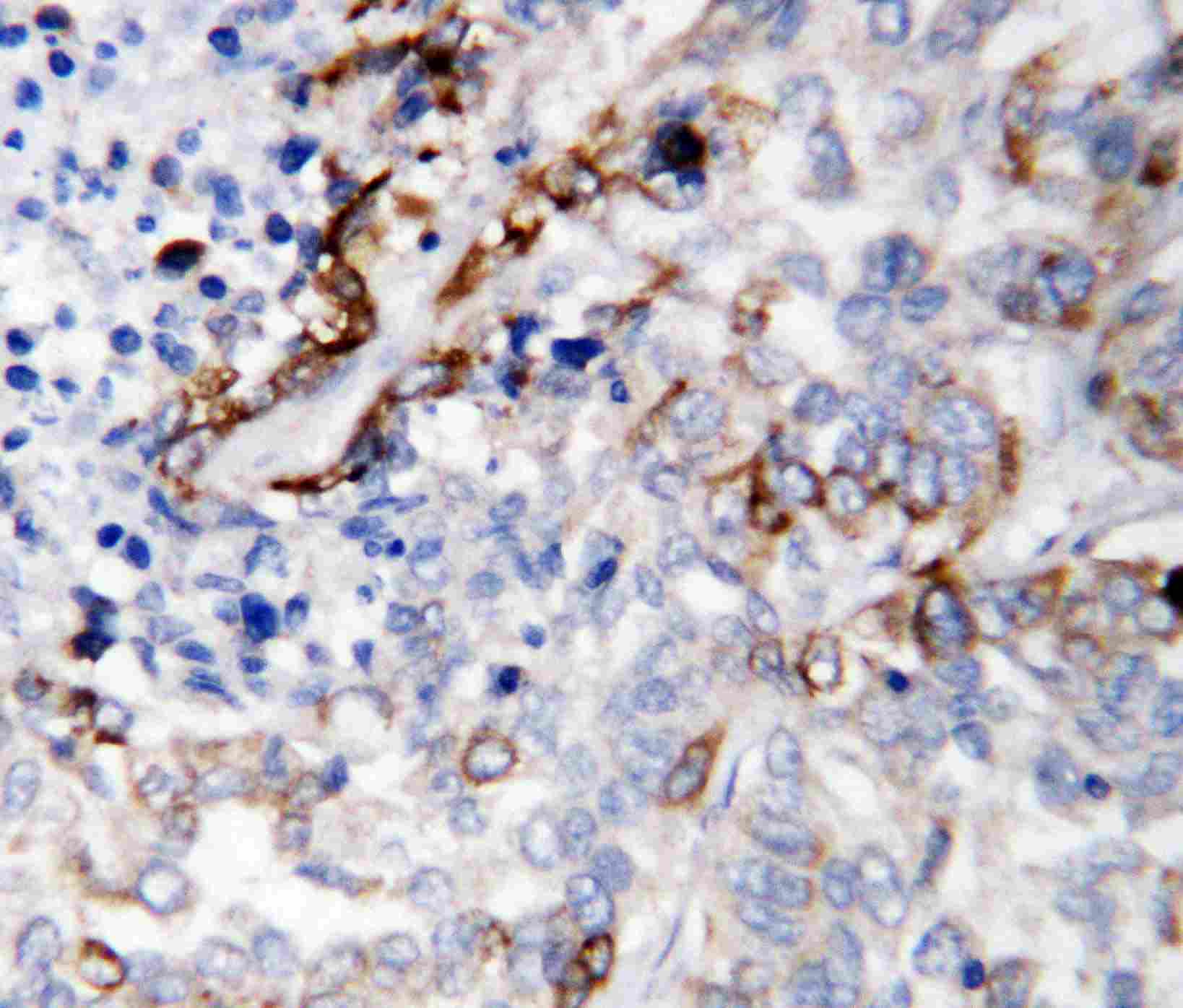 2 - Anti-LAMC2 Antibody ABO10896