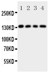 1 - Anti-LAMC2 Antibody ABO10896