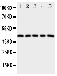 1 - Anti-Prostaglandin E Receptor EP1 Antibody ABO10897