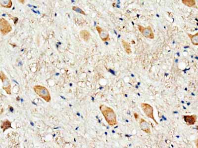 2 - Anti-Dopamine Receptor D3 Antibody ABO10898