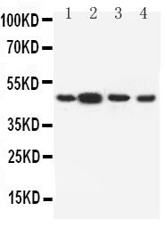 1 - Anti-Dopamine Receptor D3 Antibody ABO10898