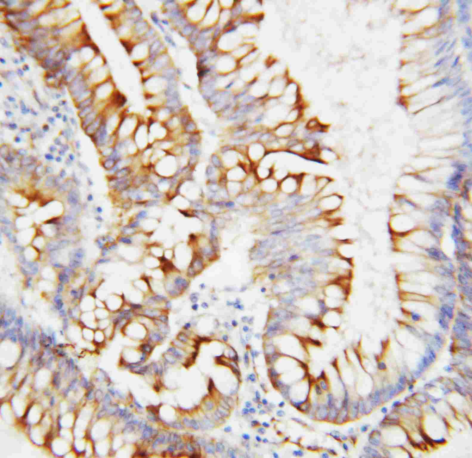 2 - Anti-SPARC Antibody ABO10899