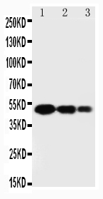 1 - Anti-SPARC Antibody ABO10899
